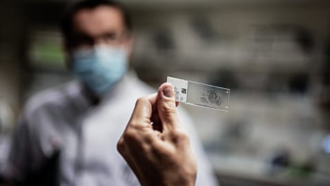 A scientist works on the analysis of a tumor on September 2, 2020 in Dijon Georges-François Leclerc Cancer Center