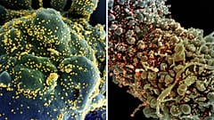 Cellule infettate dal Sars-CoV-2. Il virus si attacca attraverso una proteina, Spike, resa "inoffensiva" dagli anticorpi monoclonali