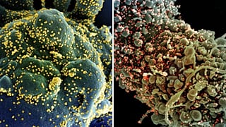 Cellule infettate dal Sars-CoV-2. Il virus si attacca attraverso una proteina, Spike, resa "inoffensiva" dagli anticorpi monoclonali