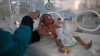 5 yaşın altındaki her altı çocuktan biri bu yıl hayatını kaybetme riski taşıyor