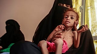 هشدار سازمان ملل در مورد قحطی در یمن