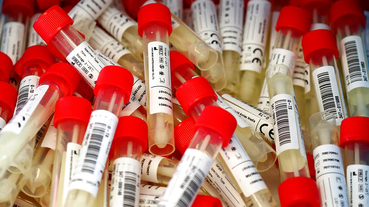 Coronavirus-Tesproben in Salzburg