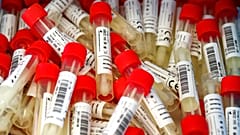 Coronavirus-Tesproben in Salzburg