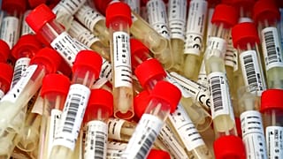 Coronavirus-Tesproben in Salzburg