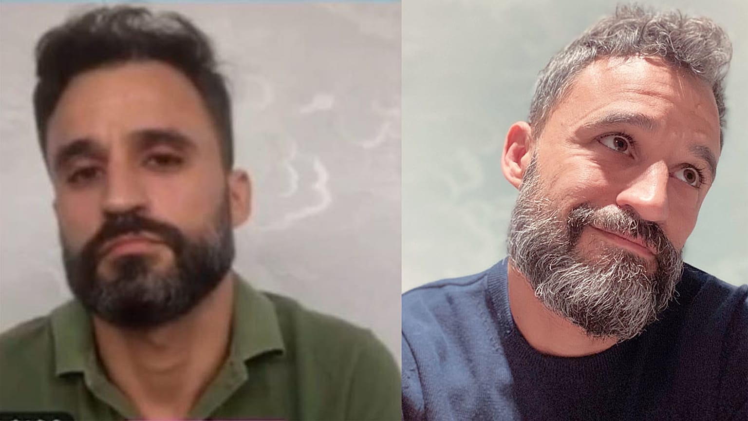 Covid-19 pandemisi sırasında 1 yılda yaşadığı fiziksel değişimi paylaşan İspanyol yoğun bakım servisi çalışanı.