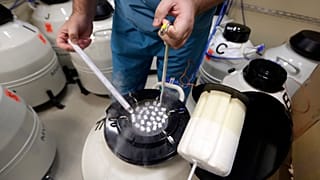 An embryologist displays some of the frozen sperm stored at Reproductive Medicine Associates of New York on Thursday, Oct. 3, 2013. Sweden is facing a sperm shortage.
