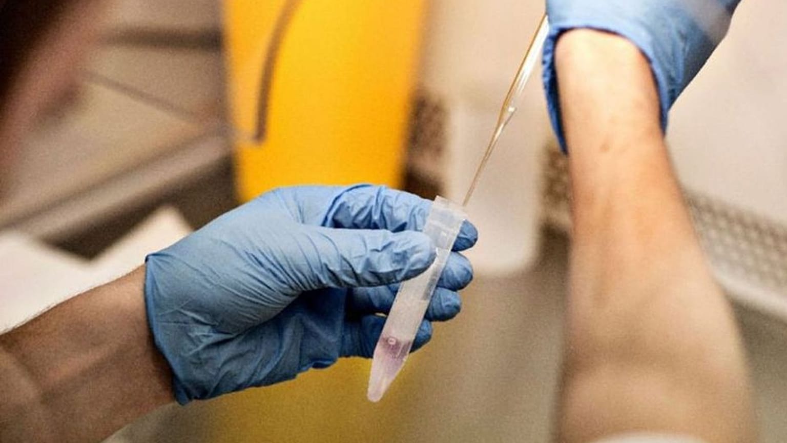 Sperm örneği