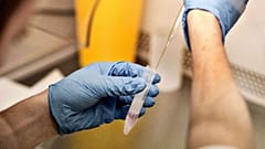Sperm örneği