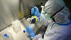  Japon araştırmacılar Covid-19'u 5 dakikada saptayabilen test metodu buldu