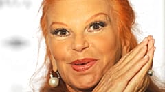 MILVA
