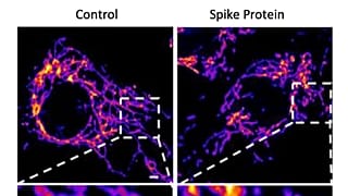 Le cellule endoteliali sane (a sinistra) quelle colpite dalla proteina S del coronavirus (a destra) mostrano la frammentazione mitocondriale nel sistema vascolare. 