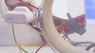 وزن نوزادان به دنیا آمده بین ۵۰۰ گرم تا یک کیلوگرم است 