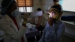 21 maggio 2021: un medico controlla un uomo guarito dal COVID-19 e ora  infettato dal fungo nero in un ospedale governativo a Hyderabad, India,
