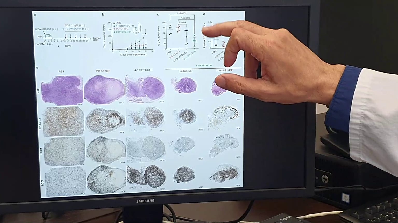 differenze nella progressione degli stessi tumori in topi con e senza trimerbodies