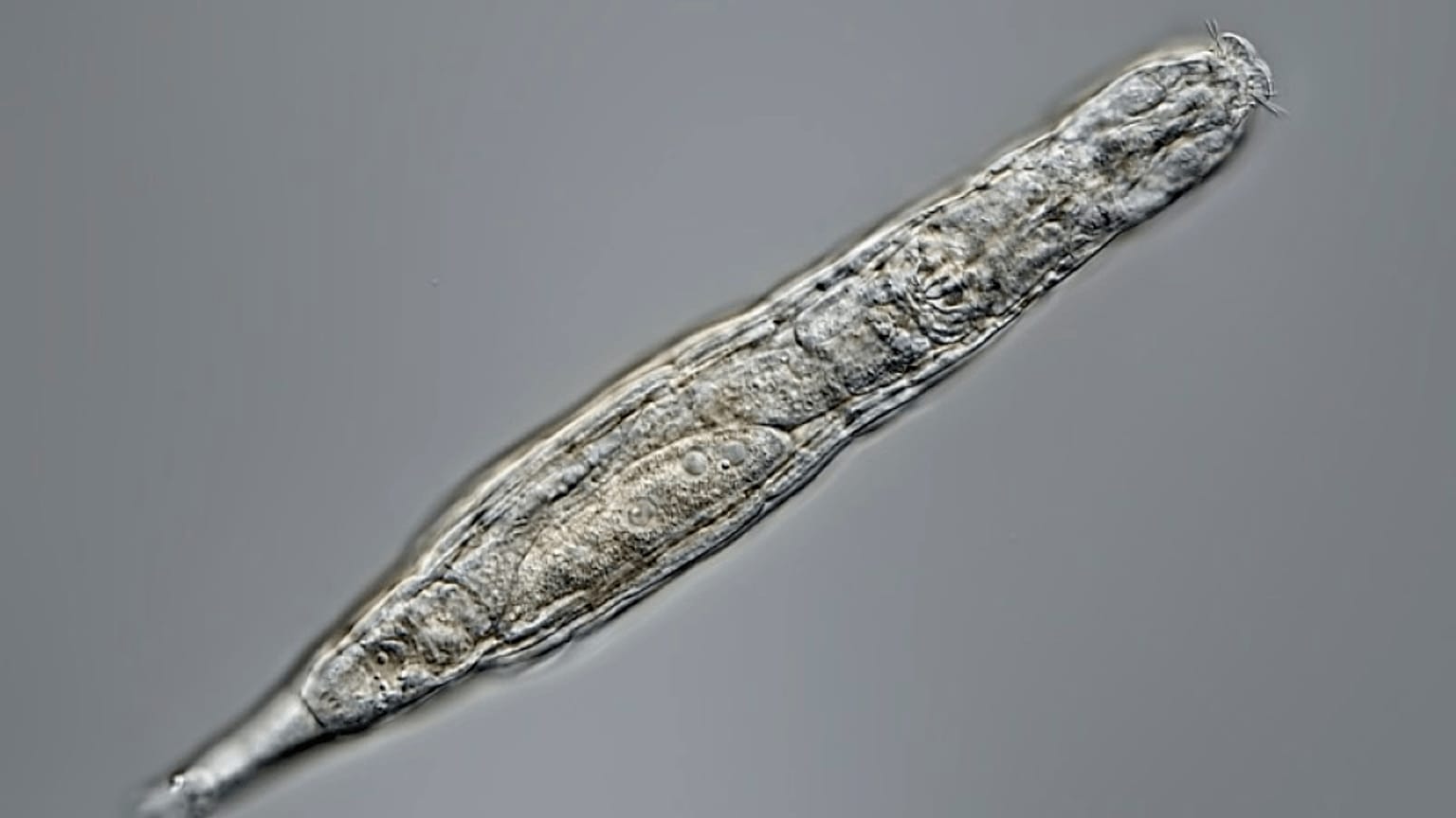 Bdelloid rotifer