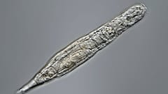 Bdelloid rotifer