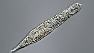 Bdelloid rotifer
