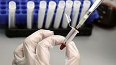 HIV ve AIDS testi