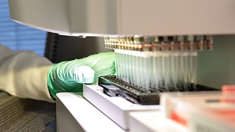 In this 2019 photo provided by Biogen, a researcher works on the development of the medication aducanumab in Cambridge, Massachusetts. 