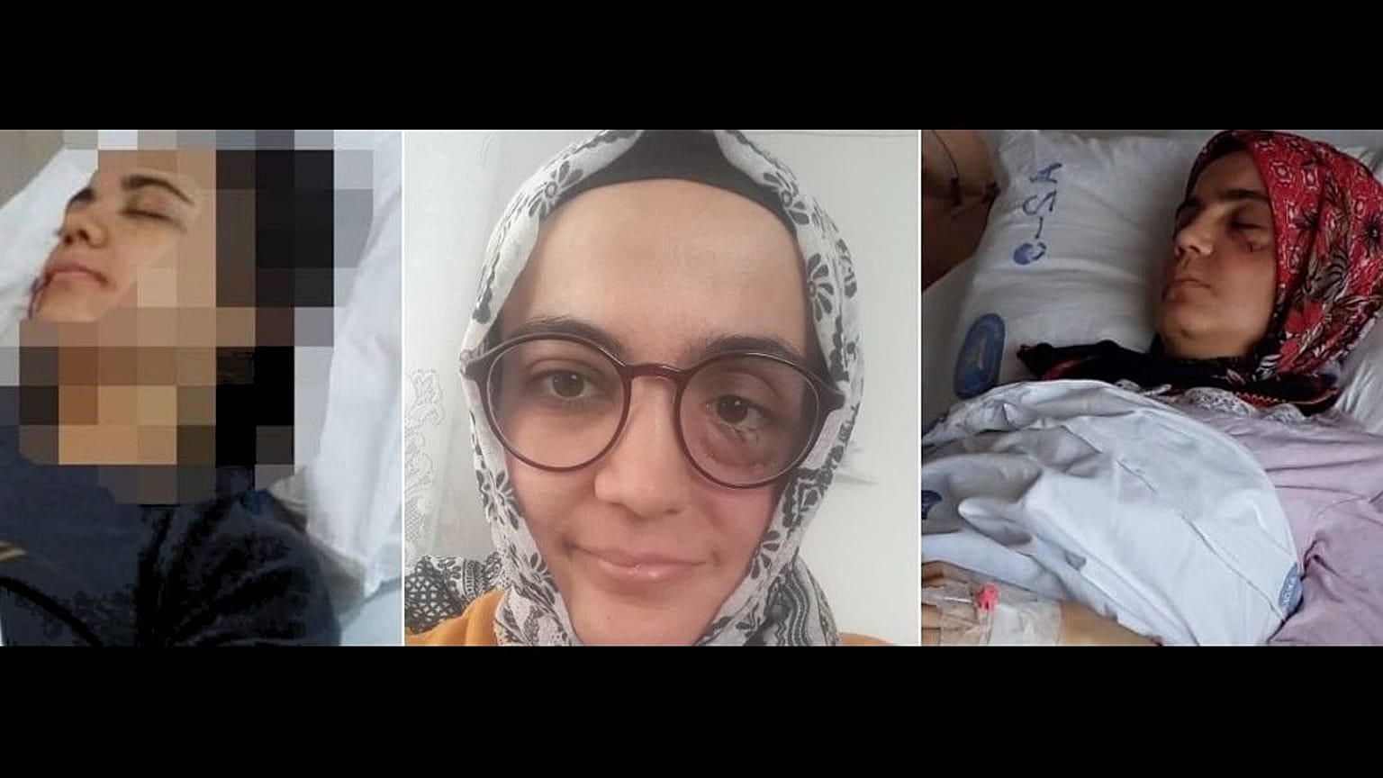 Ayşe Ösdoğan, hastalığının çok ağır olduğunu ve hapishane şartlarında hayatta kalamayacağını ifade ediyor.