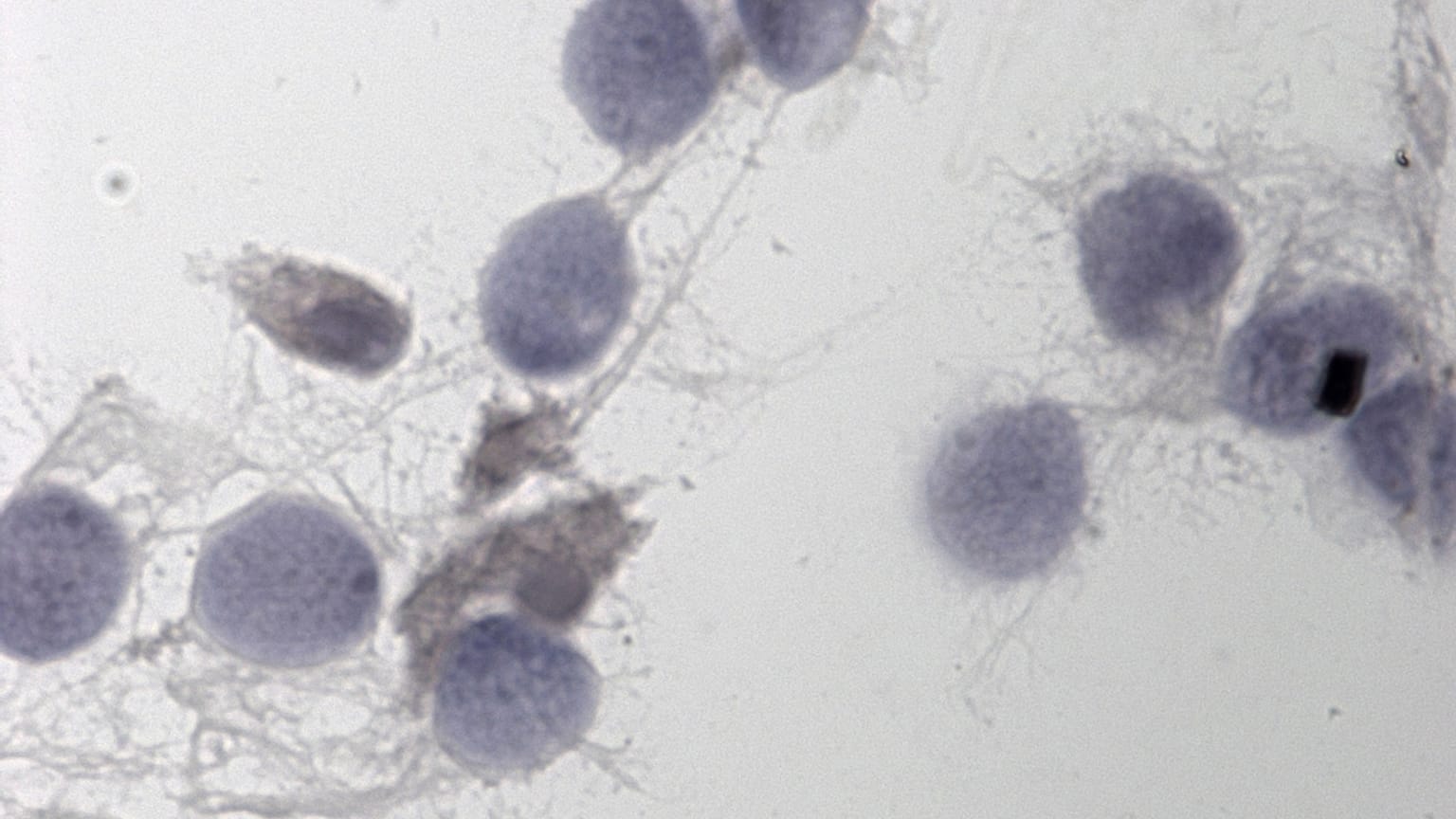 Çinli araştırmacılardan erkek kısırlığına gen tedavisi çaresi