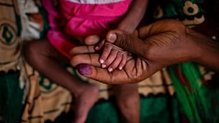Foto de una madre con su hija malnutrida en un hospital de Tigray, Etiopía
