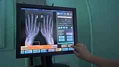 Russischer Arzt schwört auf fünf implantierte Chips