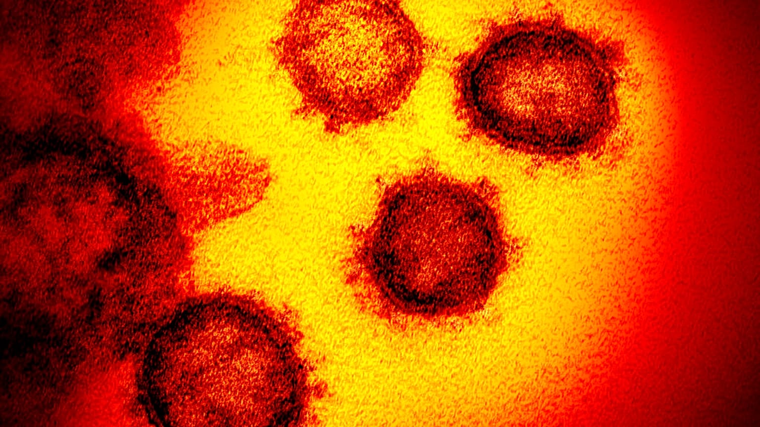 Coronavirus unter dem Mikroskop