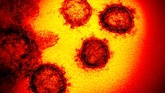 Coronavirus unter dem Mikroskop