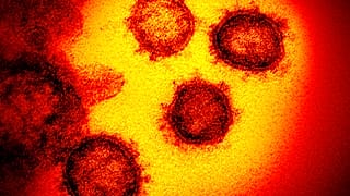 Coronavirus unter dem Mikroskop