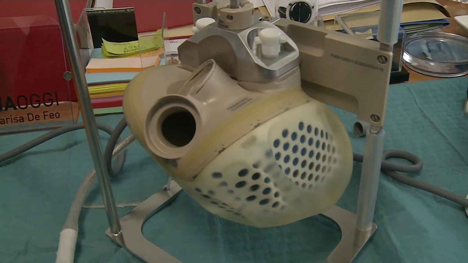 Il cuore bioartificiale "Carmat"