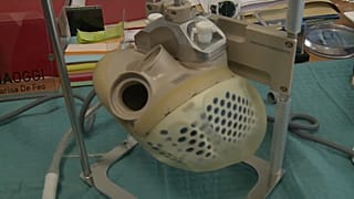 Il cuore bioartificiale "Carmat"