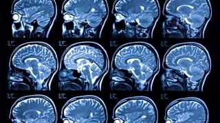 The detail from MRI scans of a patient's head.