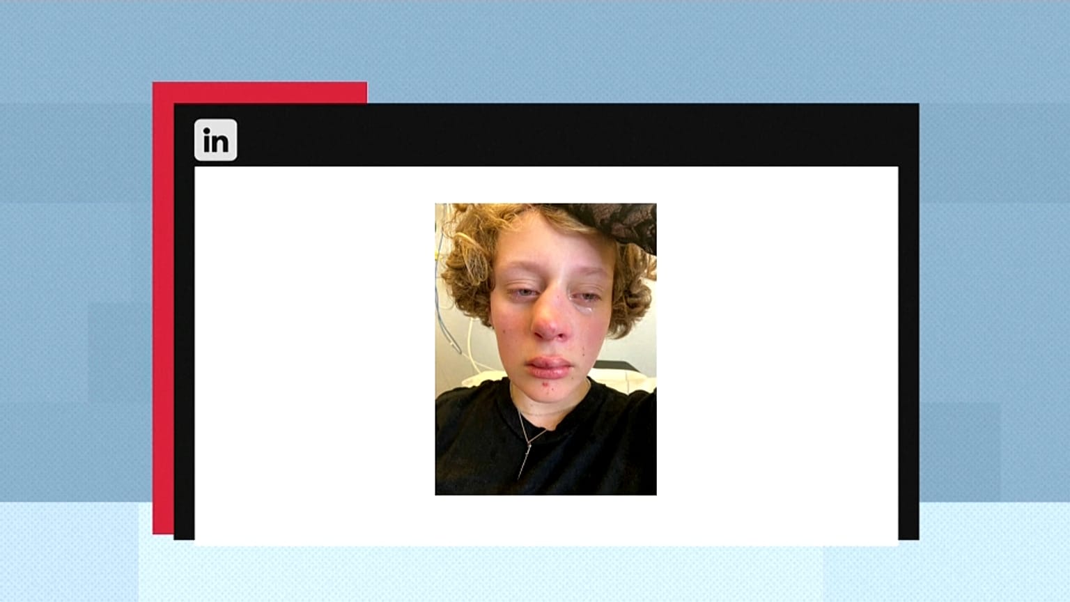 Der Vater der 14-jährigen Frédérique postete ein Foto seiner Tochter nach dem Angriff