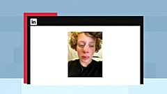 Der Vater der 14-jährigen Frédérique postete ein Foto seiner Tochter nach dem Angriff