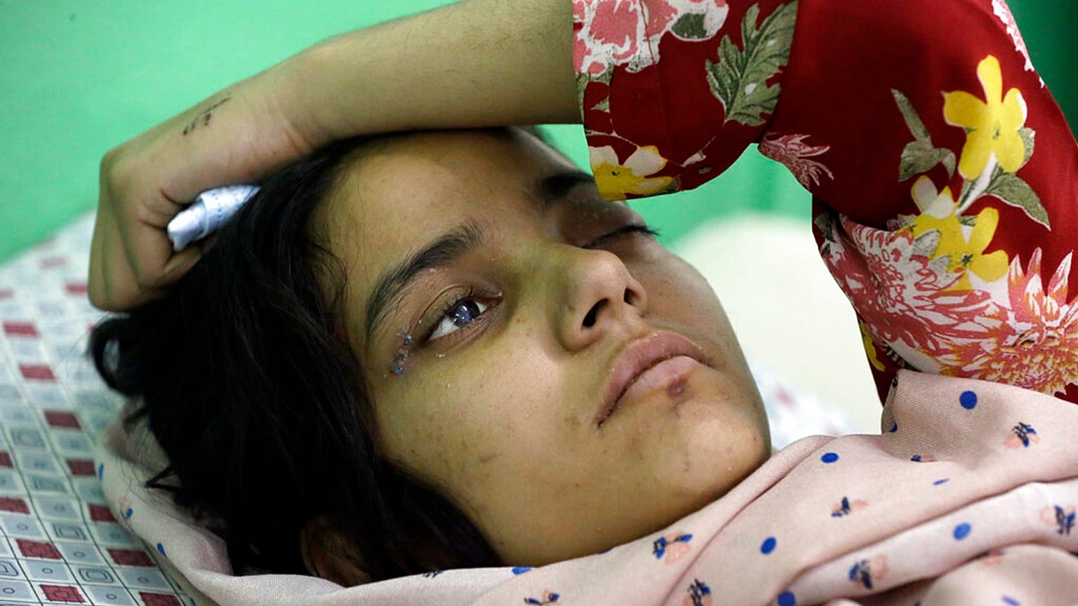 An Afghan girl receives medical care at the International Committee of the Red Cross (ICRC) physical rehabilitation center after being injured in fighting between the Taliban 