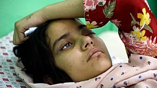 An Afghan girl receives medical care at the International Committee of the Red Cross (ICRC) physical rehabilitation center after being injured in fighting between the Taliban