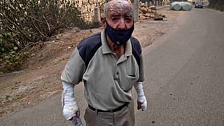 رجل جريح خلال حريق الغابات في تيزي وزو في منطقة القبائل الجزائرية، 10 أغسطس 2021