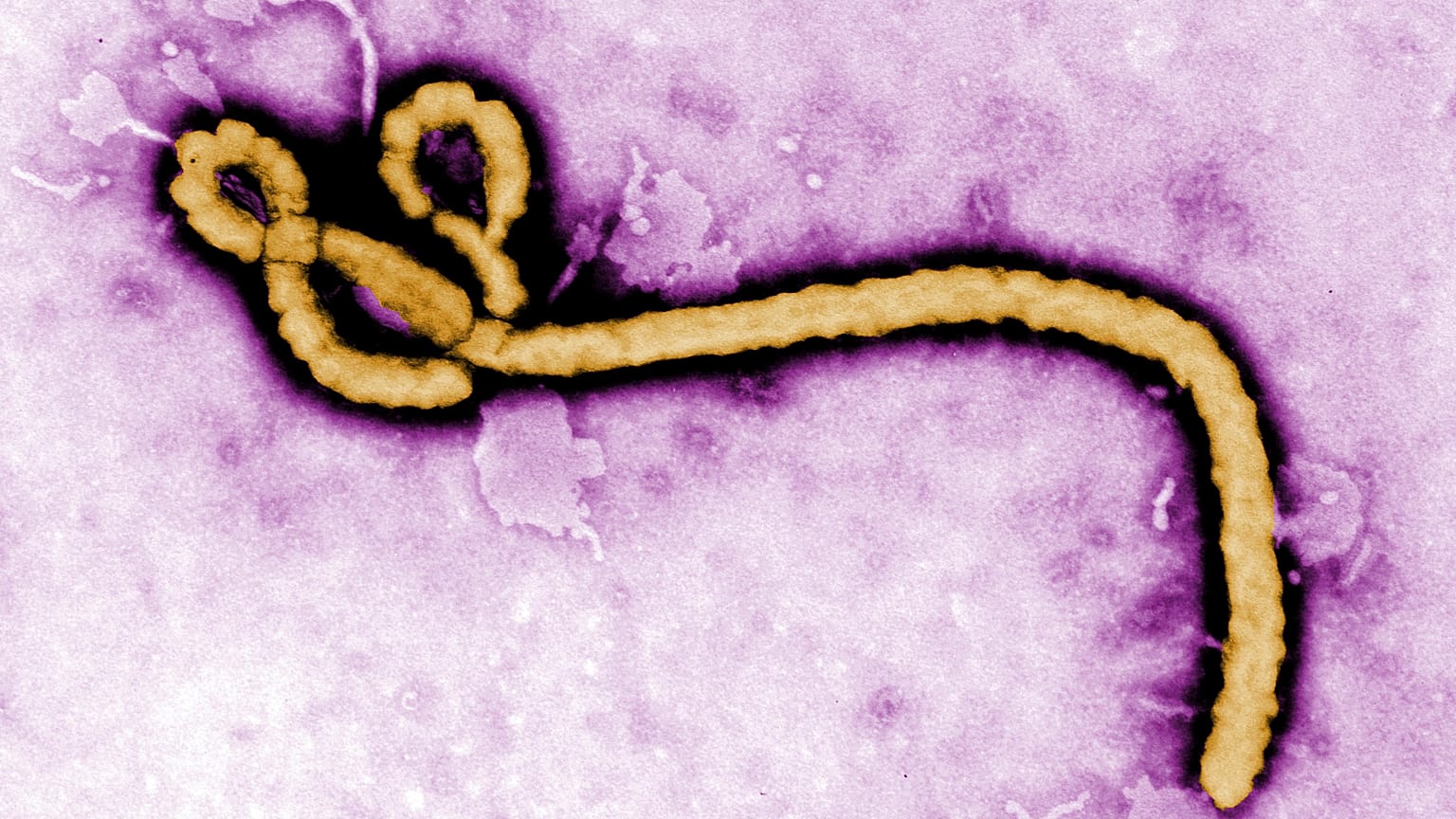 Ebola virüsü