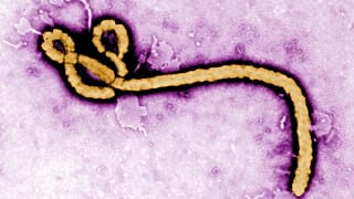 Ebola virüsü