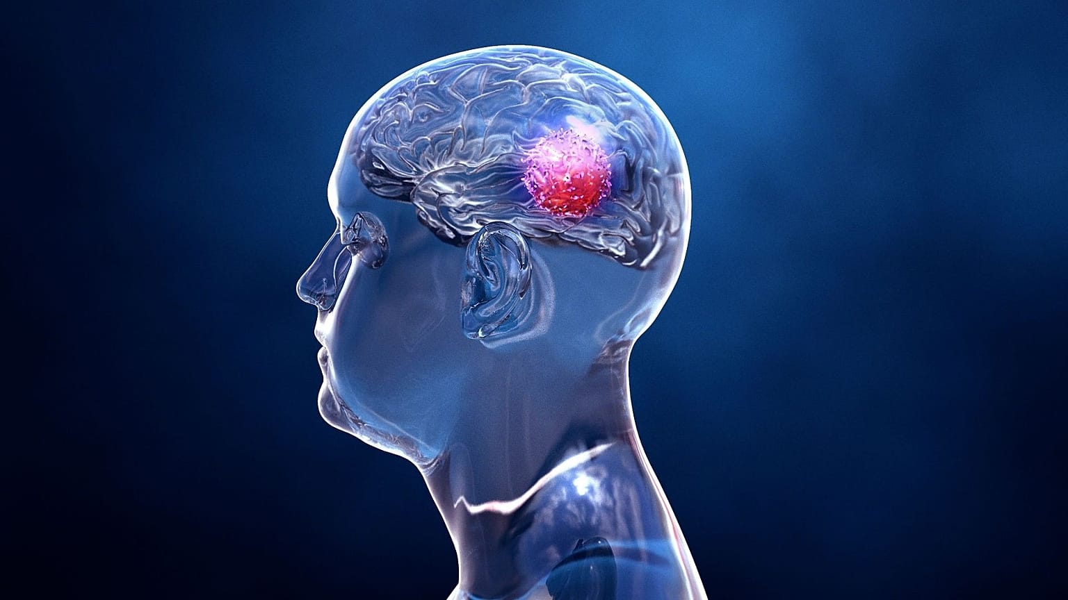 A lab in the University of Tel Aviv is 3D-printing brain tumours in order to trial new treatments for Glioblastoma, an agressive form of brain cancer. 