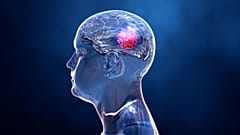 A lab in the University of Tel Aviv is 3D-printing brain tumours in order to trial new treatments for Glioblastoma, an agressive form of brain cancer. 