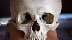 صورة من الارشيف - برادلي آدمز، دكتوراه، مدير أنثروبولوجيا الطب الشرعي في مكتب مدينة نيويورك كبير الفاحصين الطبيين يعالج عينات تشريحية في المختبر،  14 أغسطس 2012