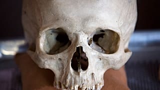 صورة من الارشيف - برادلي آدمز، دكتوراه، مدير أنثروبولوجيا الطب الشرعي في مكتب مدينة نيويورك كبير الفاحصين الطبيين يعالج عينات تشريحية في المختبر،  14 أغسطس 2012