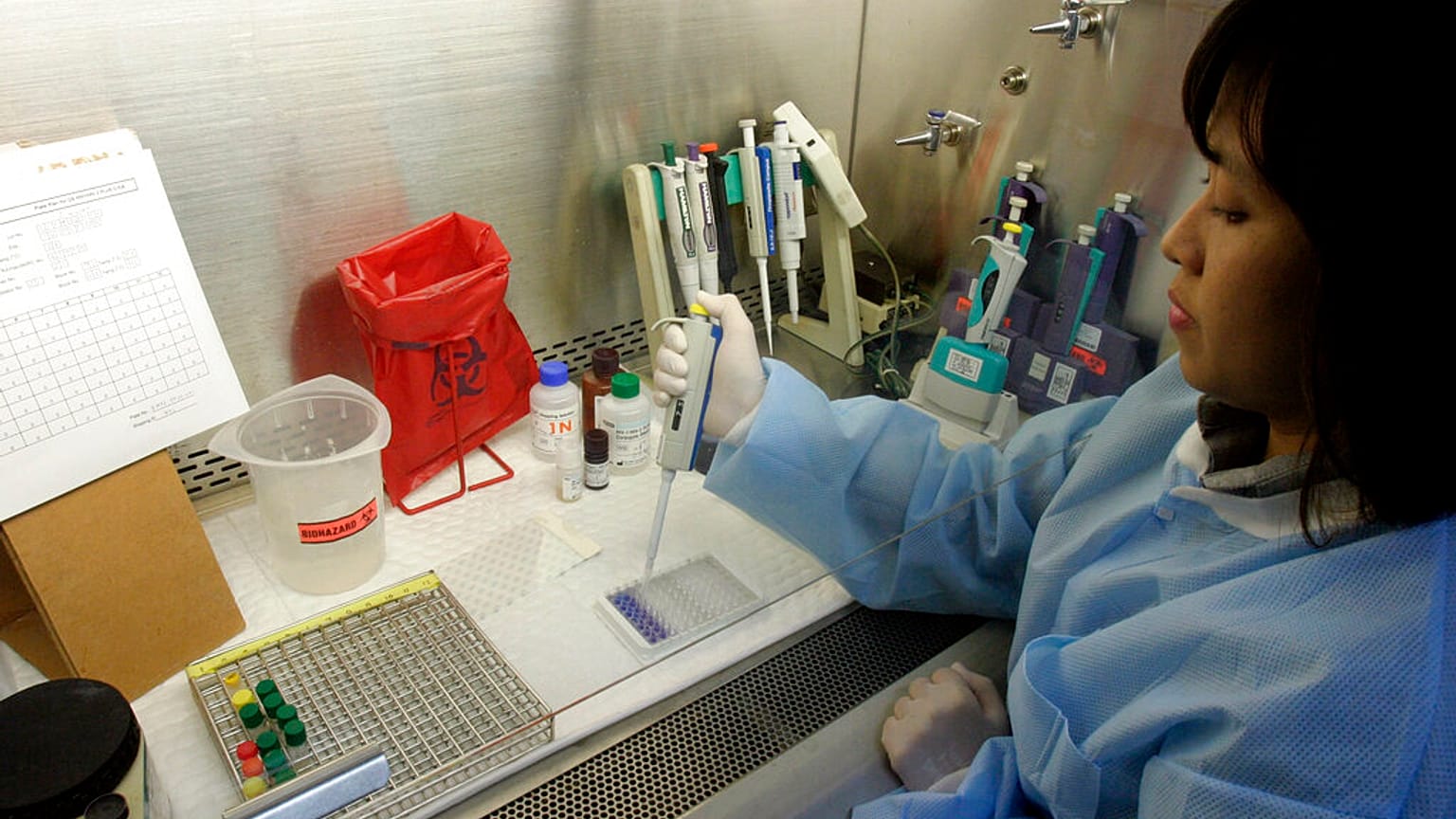 HIV aşı çalışması (Arşiv)