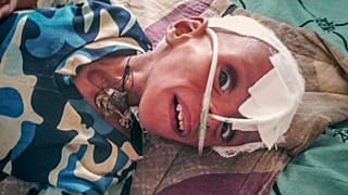 کودکانی که در شمال اتیوپی بر اثر سو‌تغذیه می‌میرند