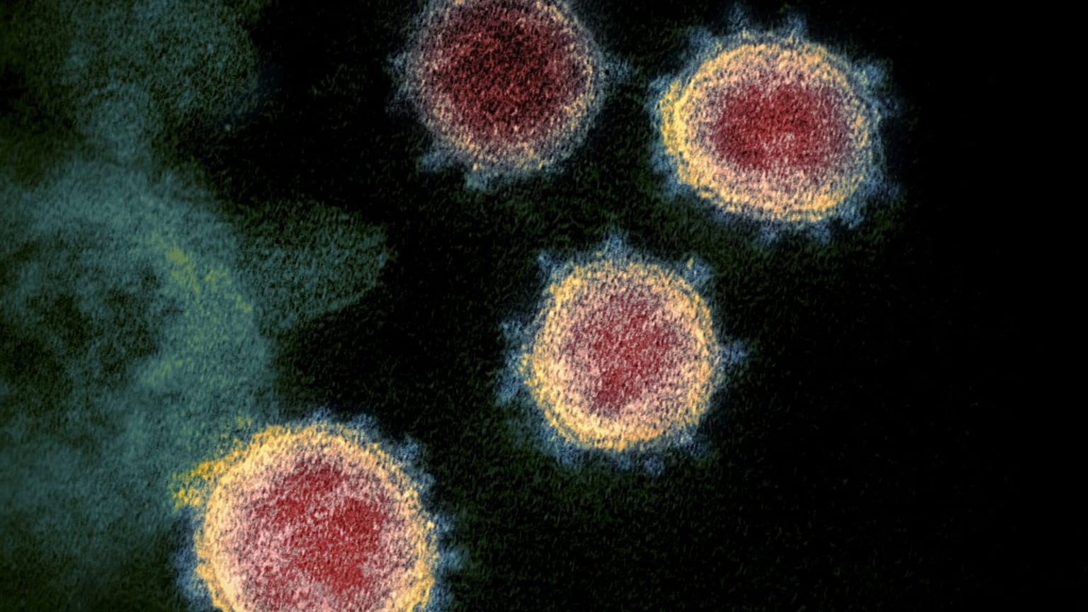 Le virus SARS CoV-2 observé au microscope