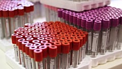 Racks of test tubes filled with blood are pictured on July 6, 2012 at a blood collection centre in Paris, France. 