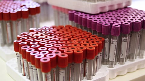 Racks of test tubes filled with blood are pictured on July 6, 2012 at a blood collection centre in Paris, France. 