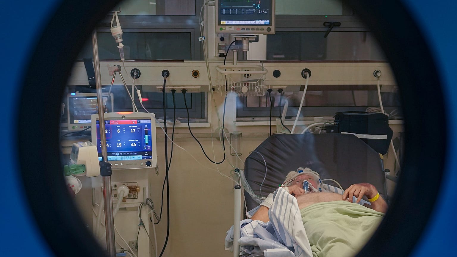 A person lies on a bed in a COVID-19 isolation room at the University Emergency Hospital in Bucharest, Romania, Friday, Oct. 22, 2021.